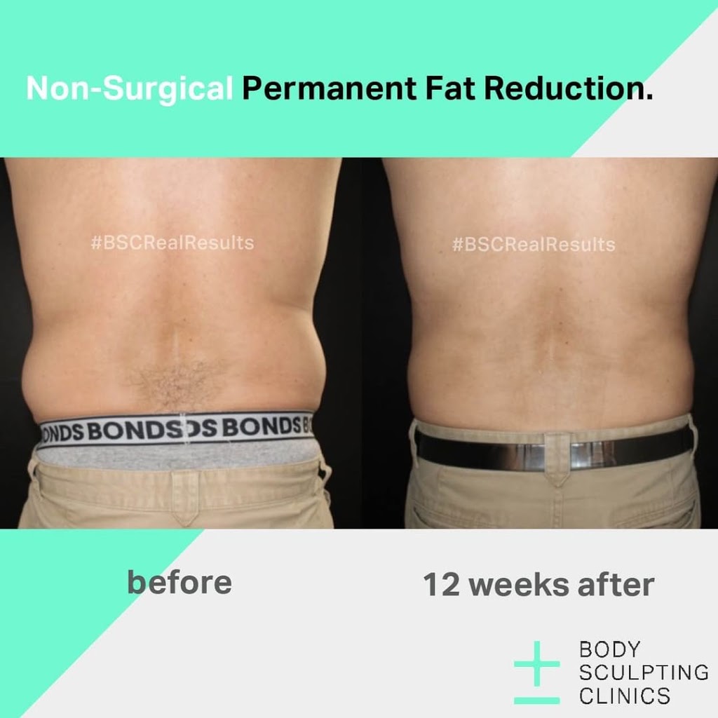 Body Sculpting Clinics - Macquarie Centre | spa | Shop 4416, Level 4, Macquarie Centre Crn Herring Rd and, Waterloo Rd, North Ryde NSW 2113, Australia | 0298781496 OR +61 2 9878 1496