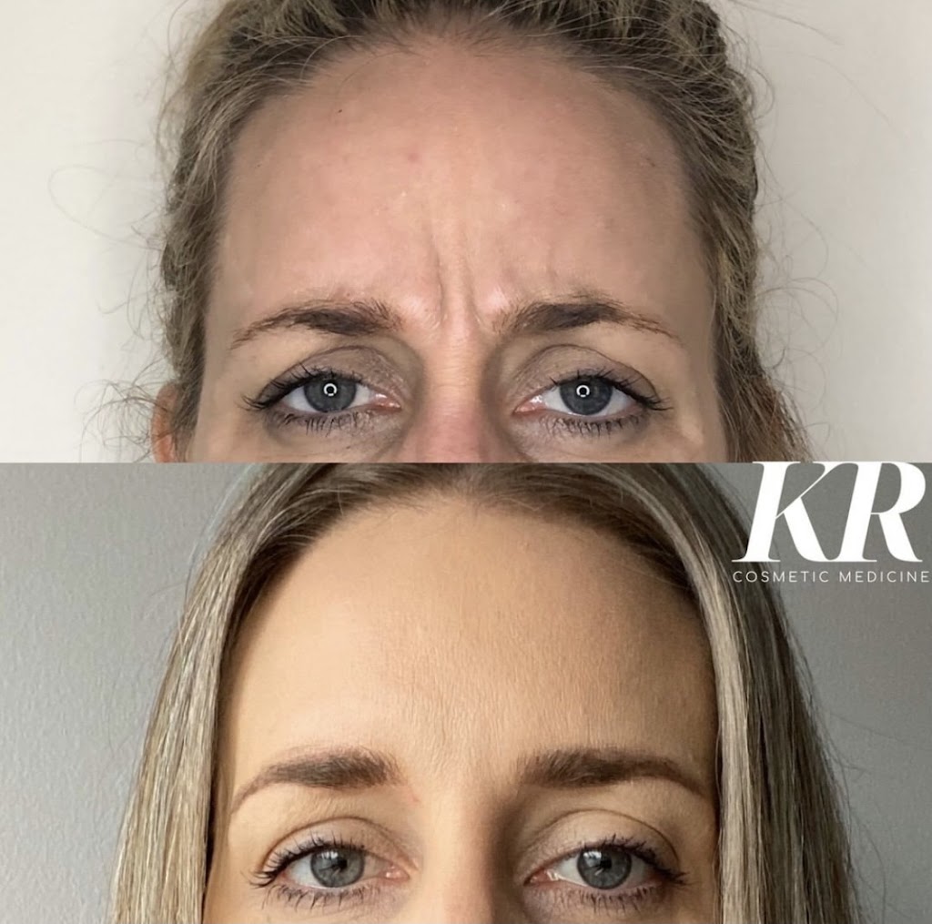 KR Cosmetic Medicine | 450 Gaffney St, Pascoe Vale VIC 3044, Australia | Phone: 0421 218 575