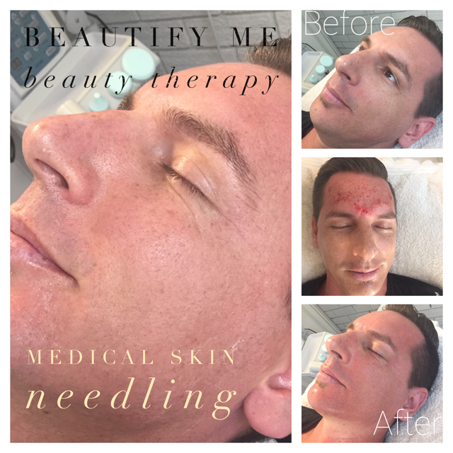 Beautify Me Beauty Therapy | 11 Laraine Ct, Bonbeach VIC 3196, Australia | Phone: 0438 165 092