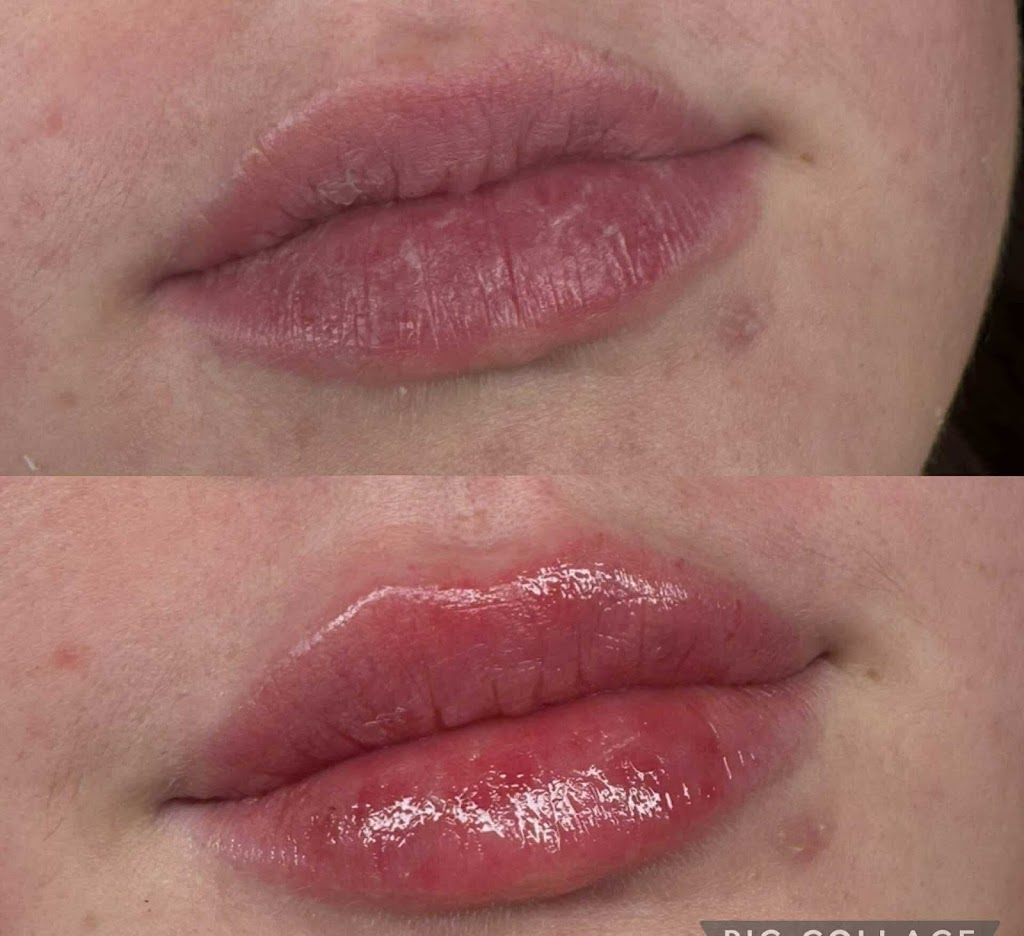 LULA AESTHETICS | 13 Harold St, Wendouree VIC 3355, Australia | Phone: 0411 667 116