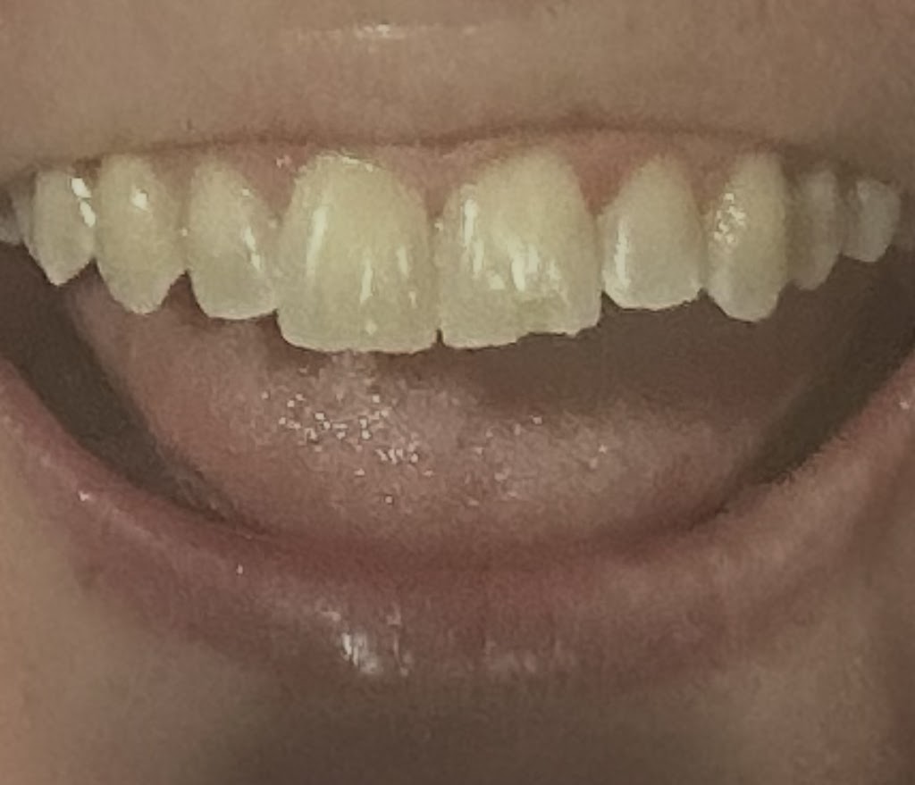 West Gippsland Dental | 54 Main S Rd, Drouin VIC 3818, Australia | Phone: (03) 5644 1323