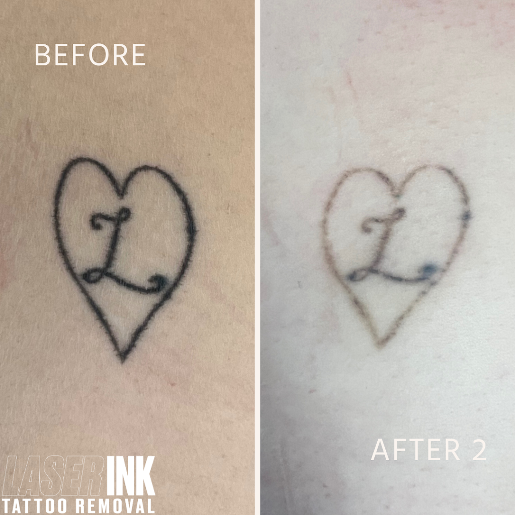 Laser Ink | 11/260 Captain Cook Dr, Kurnell NSW 2331, Australia | Phone: 0413 850 148