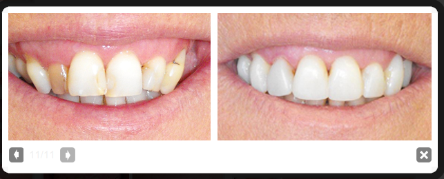 Lakes Dental Centre | dentist | 42 Berrigan Dr, South Lake WA 6164, Australia | 0894179779 OR +61 8 9417 9779