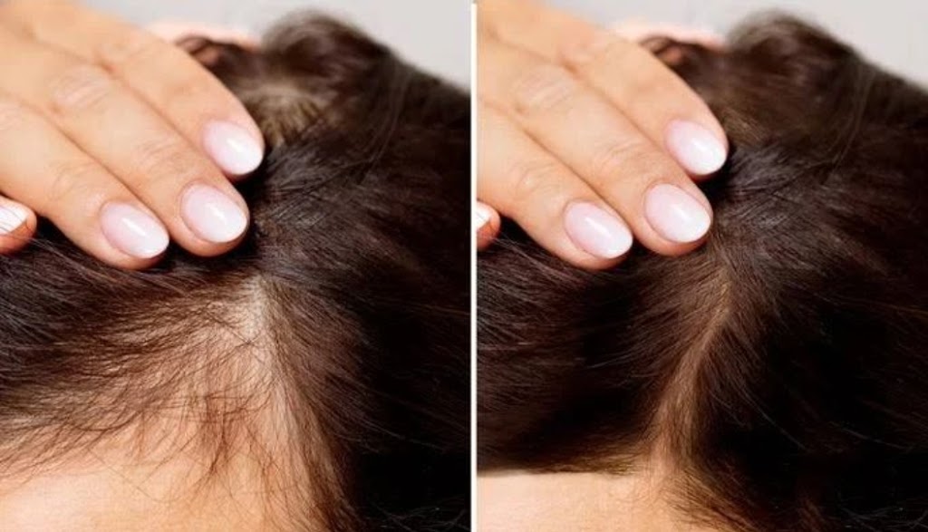 Sydney Cosmetic Clinic | Shop 1/570 New Canterbury Rd, Hurlstone Park NSW 2193, Australia | Phone: 0458 030 177