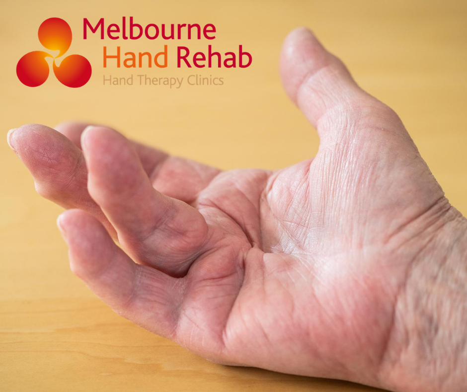 Melbourne Hand Rehab - Werribee | physiotherapist | 85 Synnot St, Werribee VIC 3030, Australia | 0394585166 OR +61 3 9458 5166