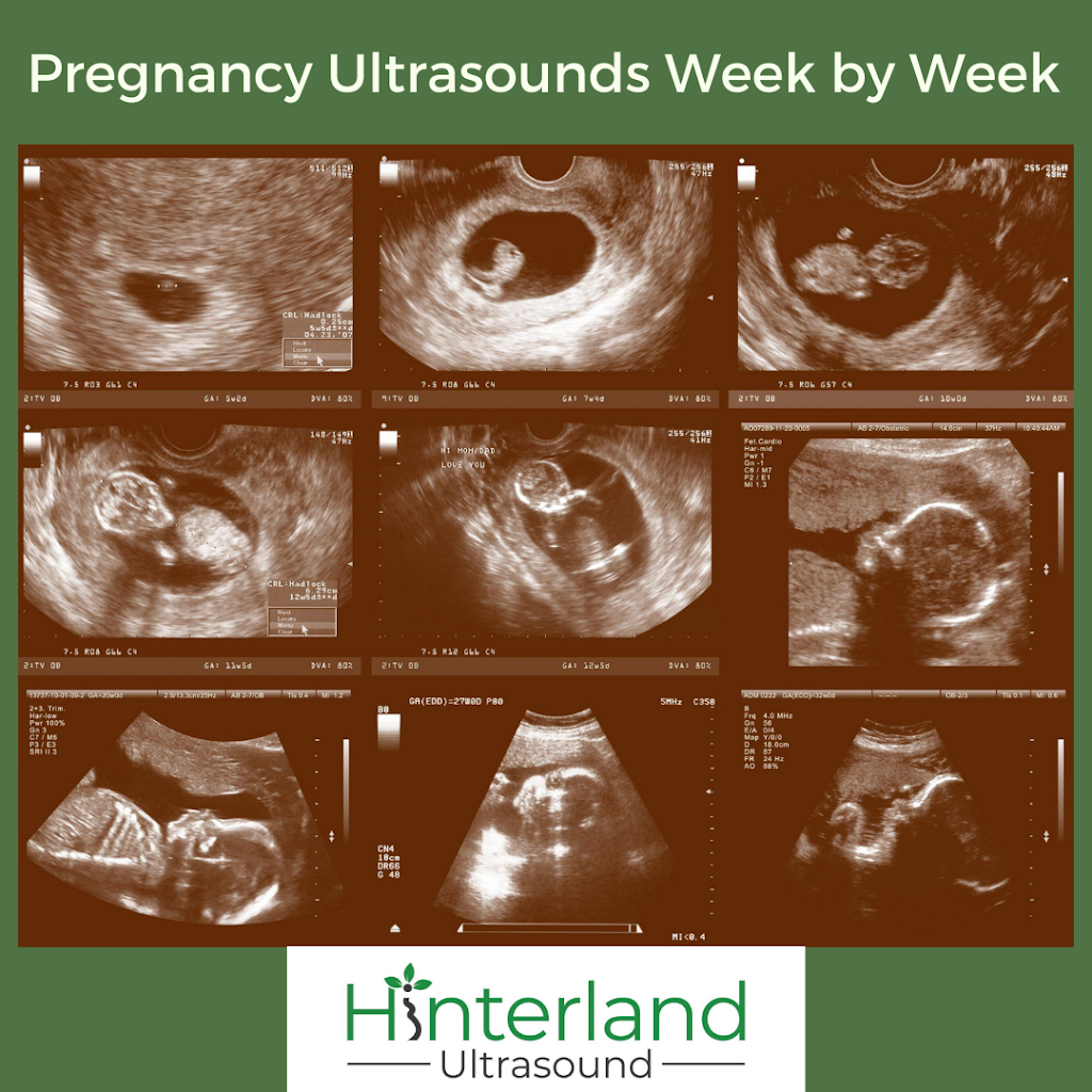 Hinterland Ultrasound | health | 13 Commercial Rd, Alstonville NSW 2477, Australia | 0266872433 OR +61 2 6687 2433