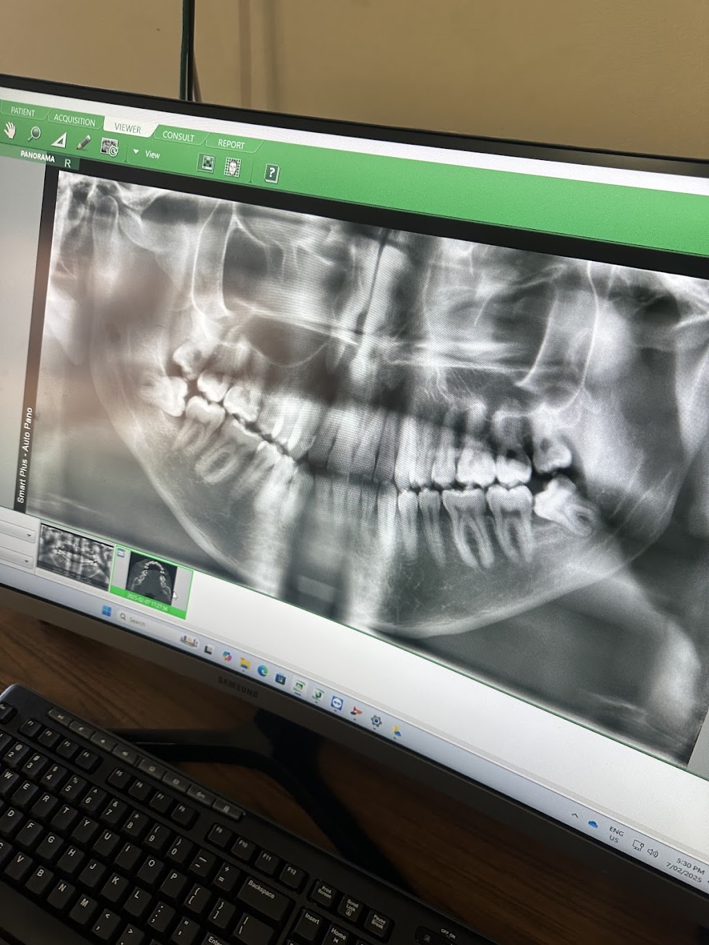 Your Orange Dentist | 296 Anson Street, Orange NSW 2800, Australia | Phone: (02) 6362 1323