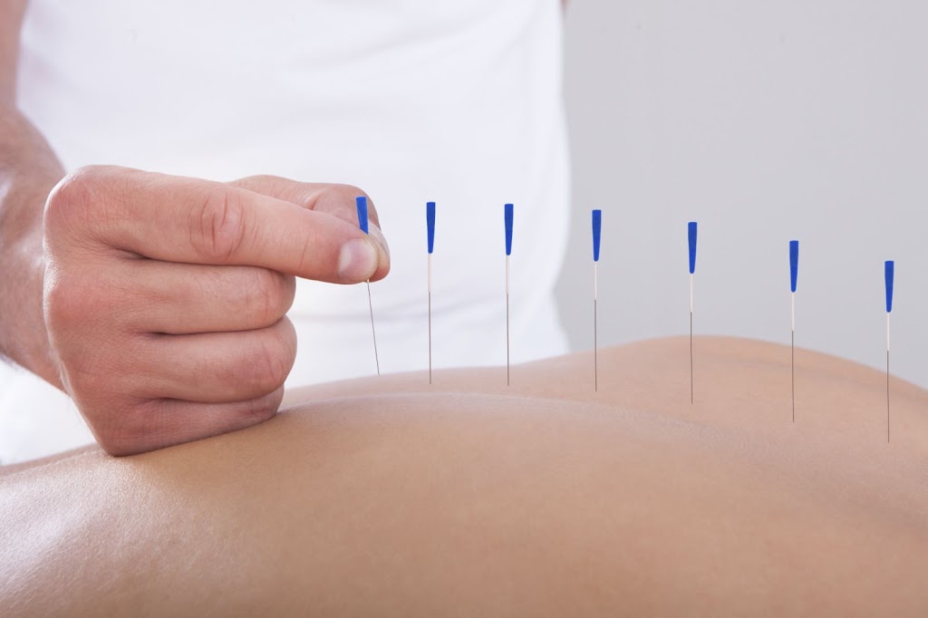 Adriana Bellicanta Acupuncture - Fertility, IVF Acupuncture | health | 32 Kerr St, Charlestown NSW 2290, Australia | 0403140720 OR +61 403 140 720