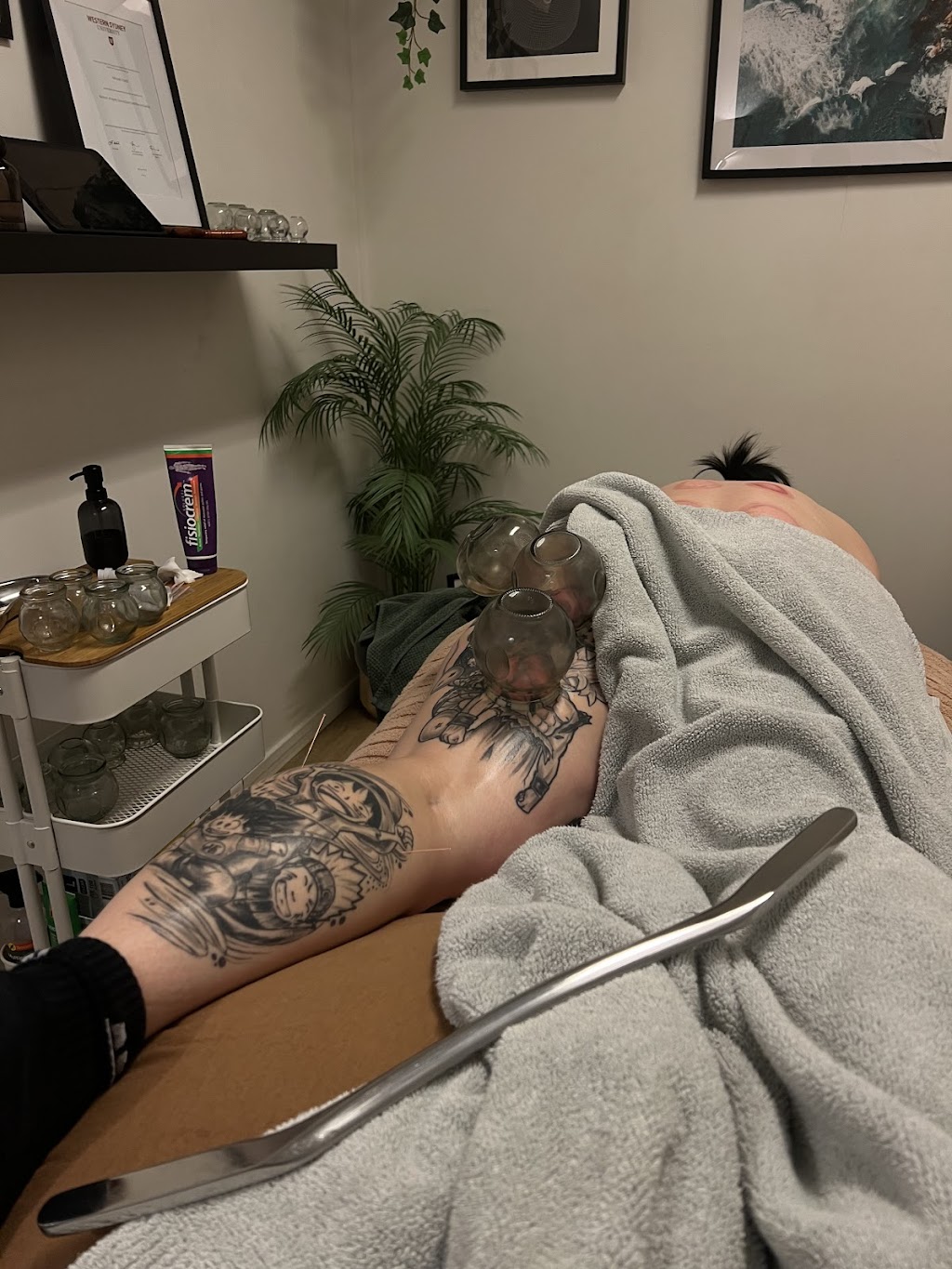MyoFix Therapy | 1 Monckton Pl, Glenfield NSW 2167, Australia | Phone: 0430 548 866