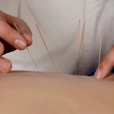 VIP Physio | 398 S Gippsland Hwy, Cranbourne VIC 3977, Australia | Phone: (03) 7038 0792