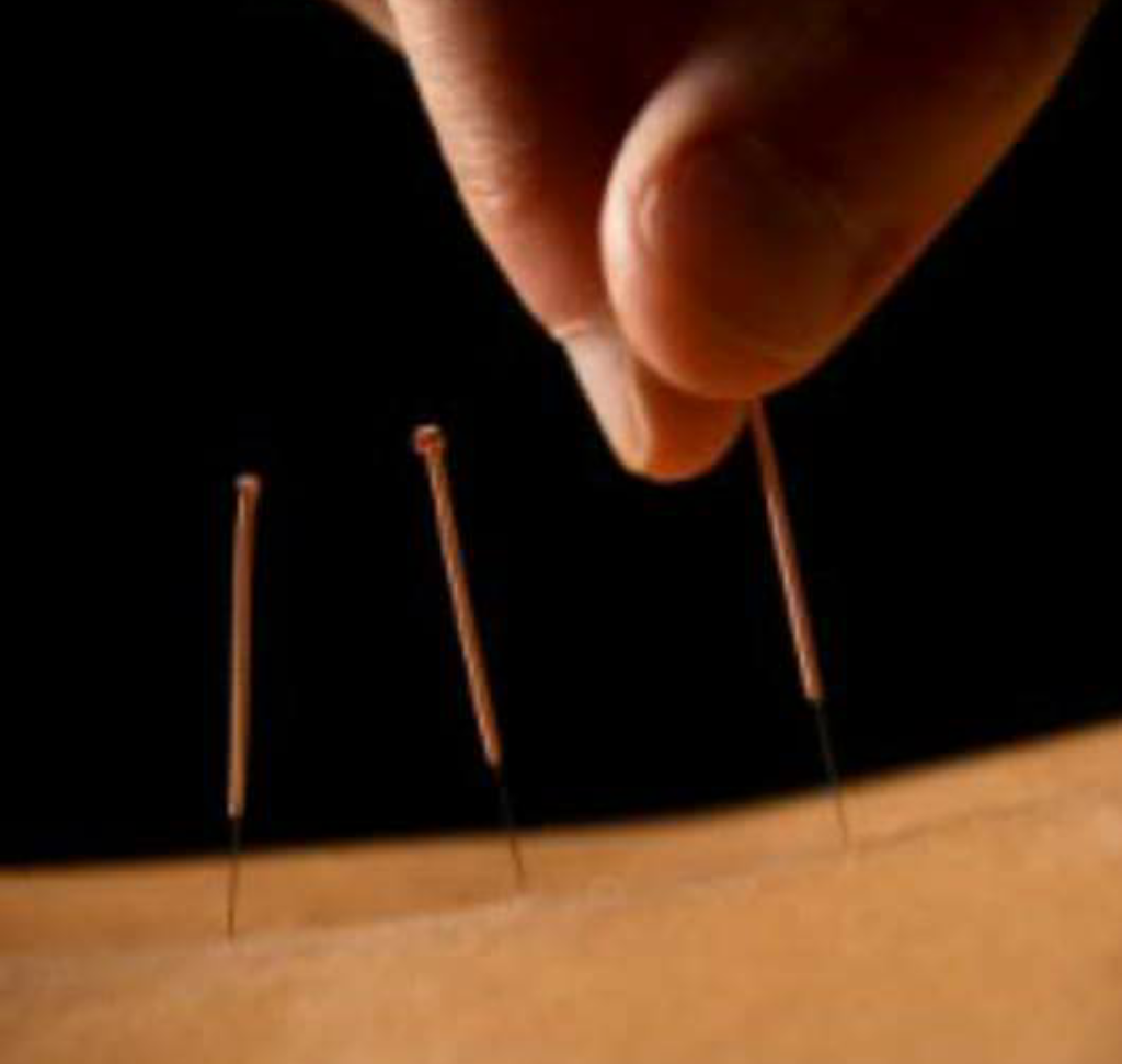 Acupuncture and Traditional Chinese Medicine - Tony Booth | Shed 1/55 Harbord Rd, Freshwater NSW 2096, Australia | Phone: 0404 185 374