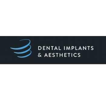 Dental Implants & Aesthetics | dentist | Suite 3/39 White Street Southport QLD 4215 | 0755031701 OR +61 7 5503 1701
