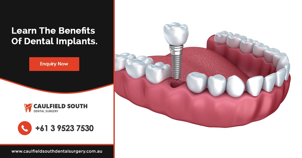 Caulfield South Dental Surgery ? | dentist | 858 Glen Huntly Rd, Caulfield South VIC 3162, Australia | 0395237530 OR +61 3 9523 7530