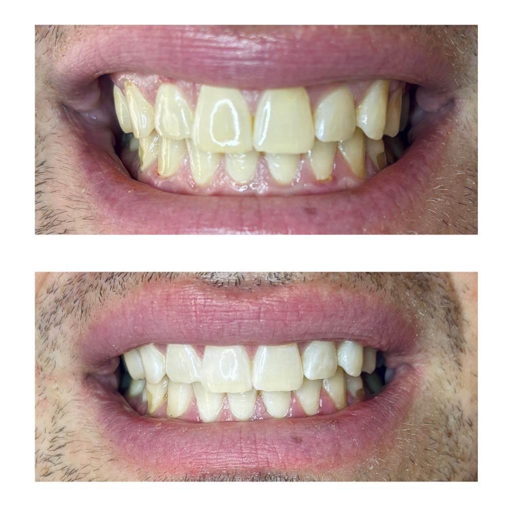 The Whitening Room | MacDougall Rd, Golden Gully VIC 3555, Australia | Phone: 0426 284 861