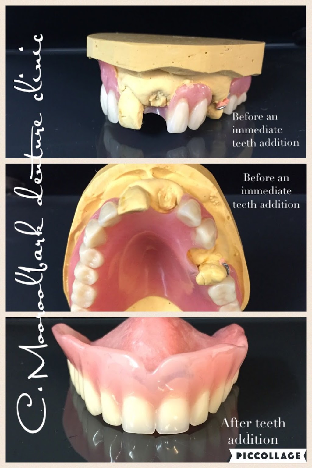Mooroolbark denture clinic . Making Smiles Come To Life | dentist | 13/91 Brice Ave, Mooroolbark VIC 3138, Australia | 0397267284 OR +61 3 9726 7284