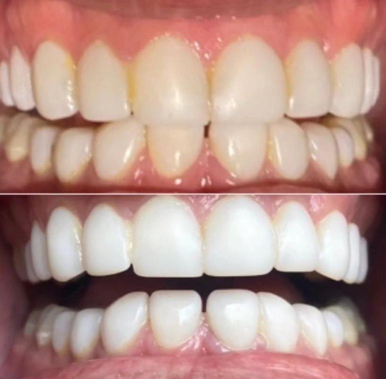Luxe Smile Beauty | 6 Garema Rd, Gwandalan NSW 2259, Australia | Phone: 0412 922 689