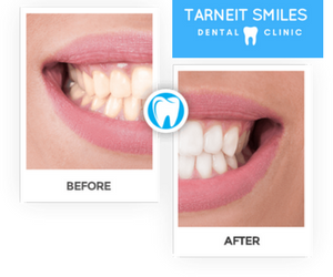 Tarneit Smiles | dentist | 937 Sayers Rd, Tarneit VIC 3029, Australia | 0387424788 OR +61 3 8742 4788