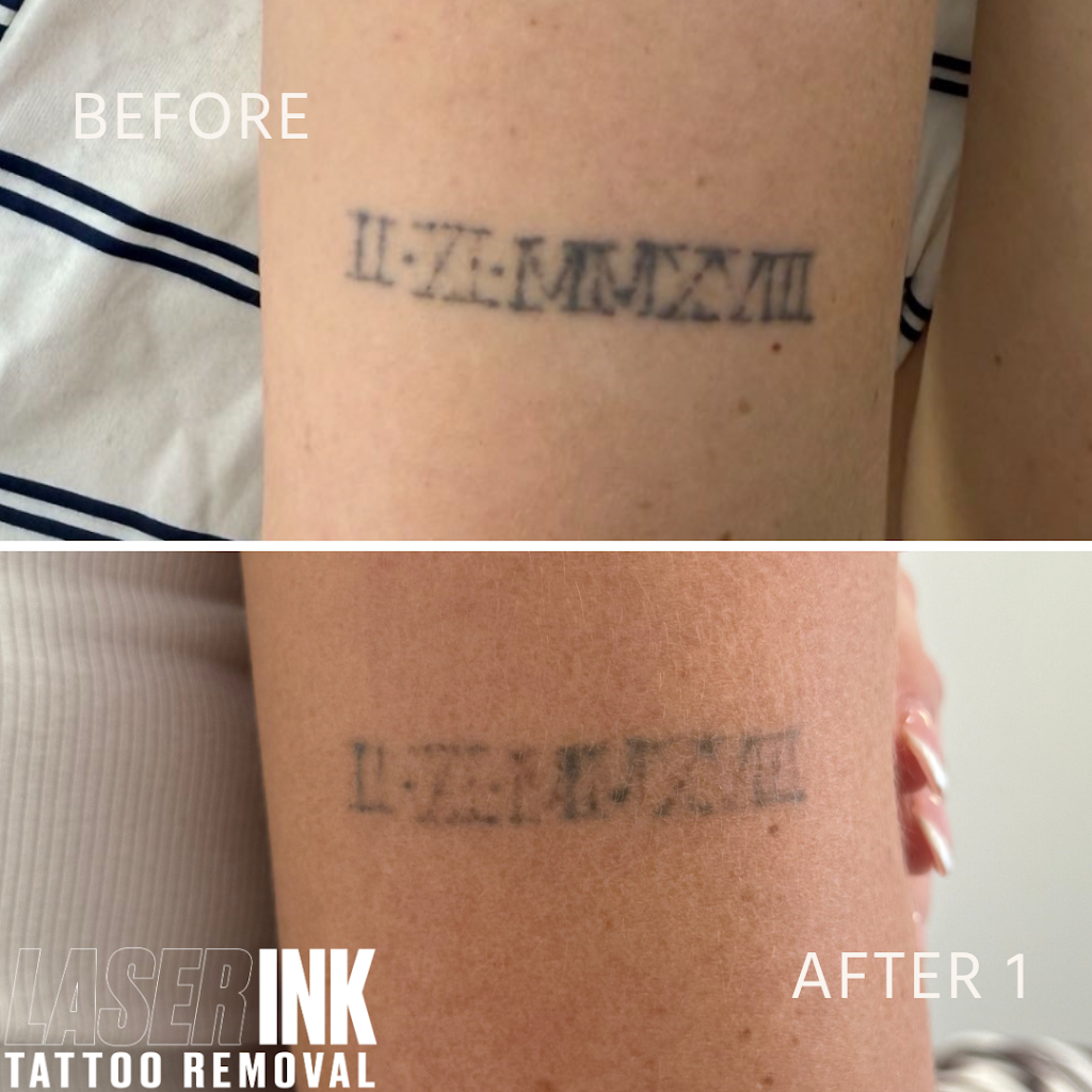 Laser Ink | 11/260 Captain Cook Dr, Kurnell NSW 2331, Australia | Phone: 0413 850 148
