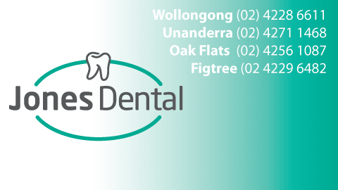 Jones Dental | dentist | 27 Central Rd, Unanderra NSW 2526, Australia | 0242711468 OR +61 2 4271 1468