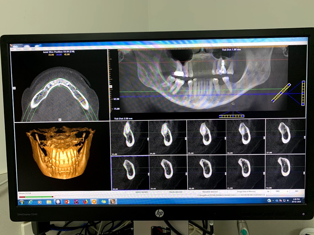 Burleigh Dentistry & Implants | dentist | 13/2 Executive Dr, Burleigh Waters QLD 4220, Australia | 0755936461 OR +61 7 5593 6461