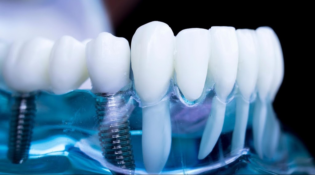 ProSantos Dental Laboratories | 28 Aruma Ave, Harkness VIC 3337, Australia | Phone: 0400 196 949