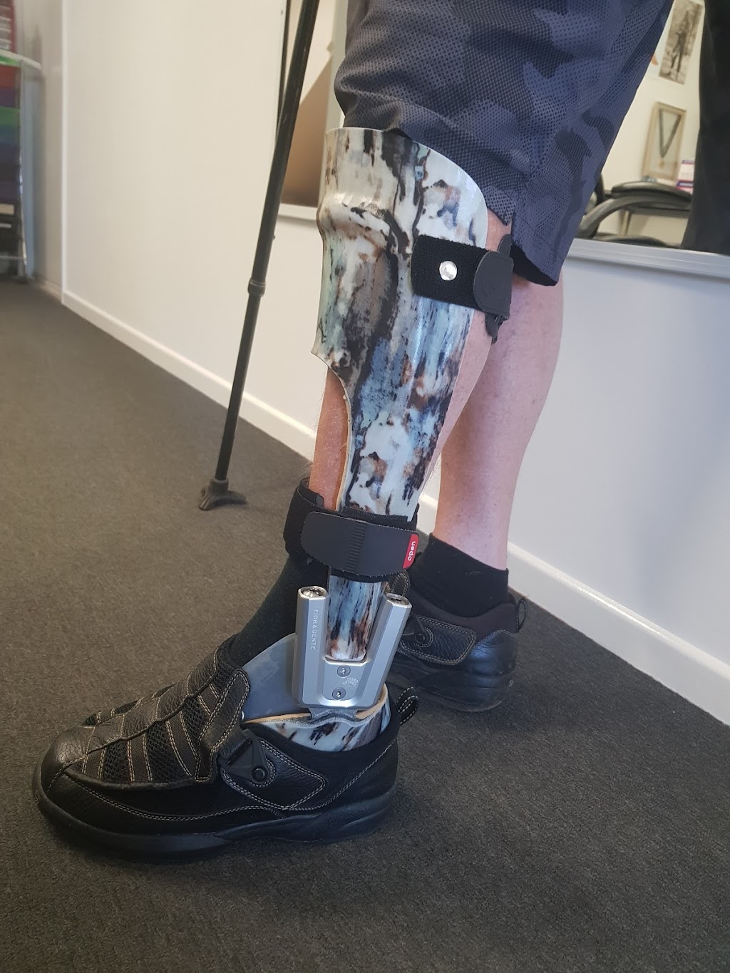 FeetFirst Orthotics & Prosthetics | 2/39 Technology Dr, Warana QLD 4575, Australia | Phone: (07) 5493 4294