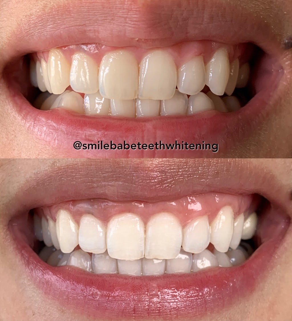 Smile Babe Teeth Whitening | 68 Cathedral Rocks Ave, Kiama Downs NSW 2533, Australia | Phone: 0423 043 736