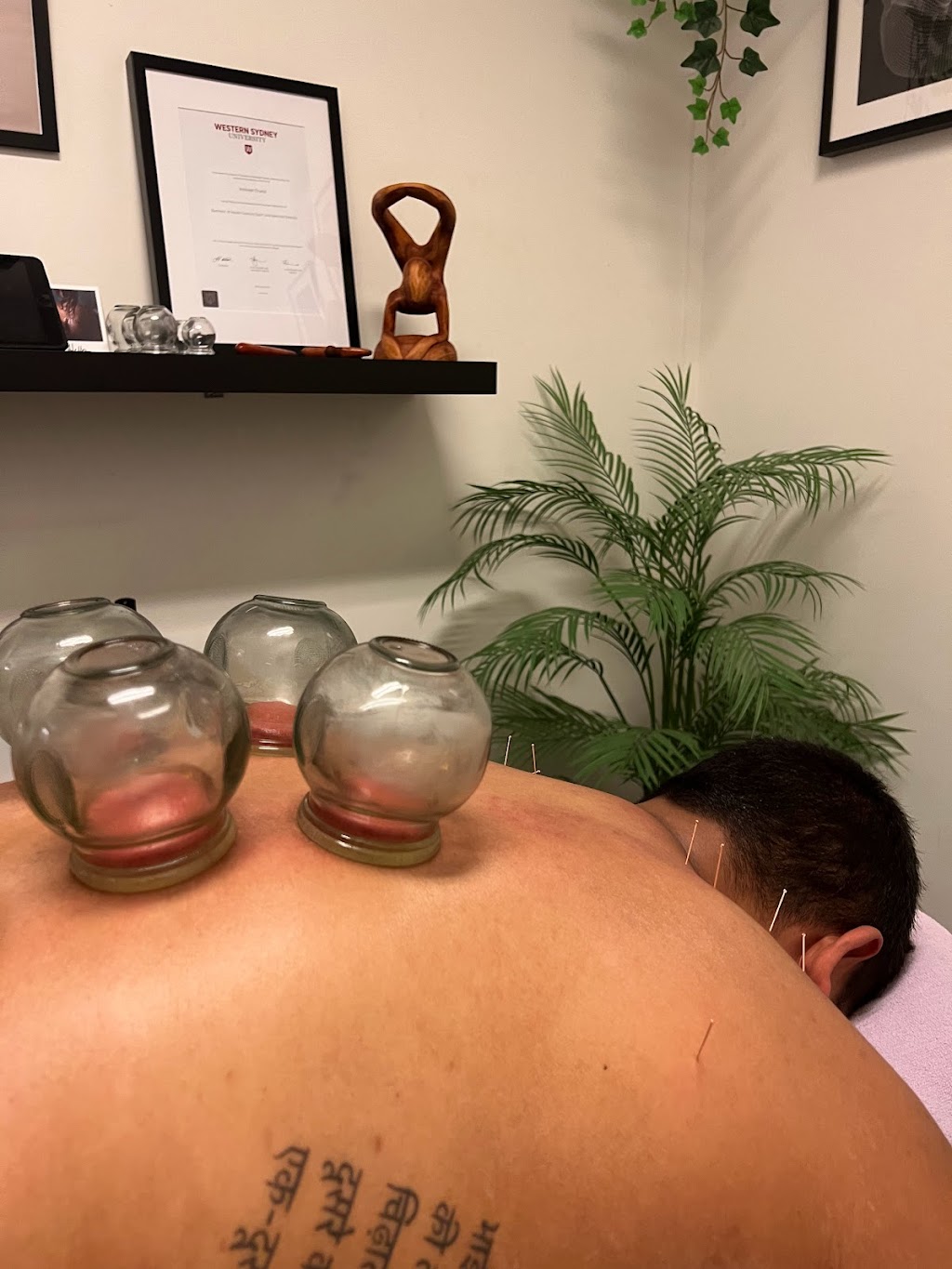 MyoFix Therapy | 1 Monckton Pl, Glenfield NSW 2167, Australia | Phone: 0430 548 866