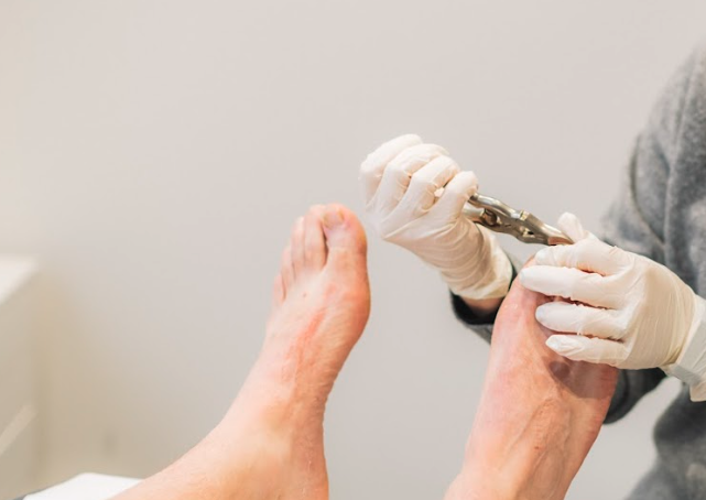 ProFeet Podiatry Miami | Level 2/2125 Gold Coast Hwy, Miami QLD 4220, Australia | Phone: (07) 5576 5832