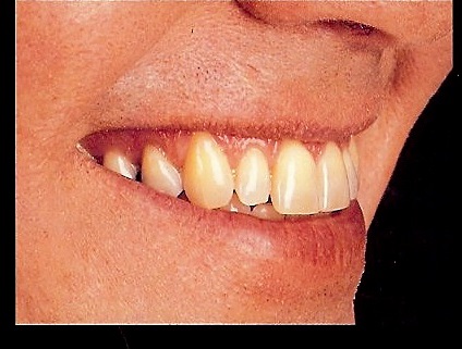 Staceys Dental Laboratory | dentist | 42 High St, Swan Hill VIC 3585, Australia | 0350331788 OR +61 3 5033 1788