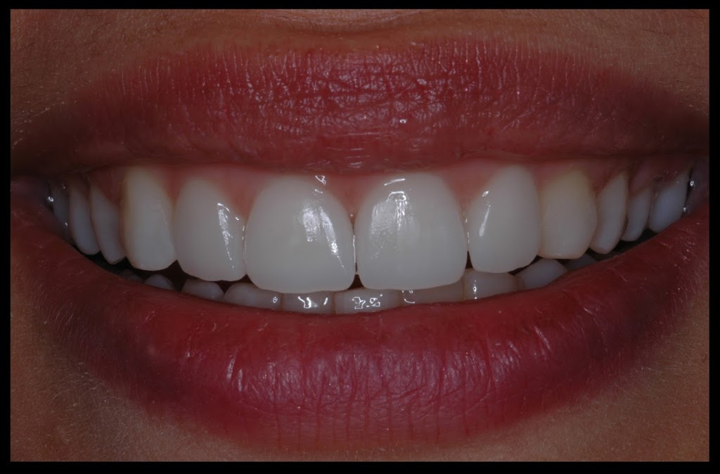 MDS Manningham Dental Specialists | 6/195 Thompsons Rd, Bulleen VIC 3105, Australia | Phone: (03) 9850 8344