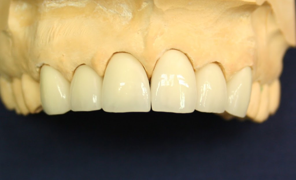 Robert Munich Dental Ceramics | dentist | 19 Greenmount Heights, Hillarys WA 6025, Australia | 0894028225 OR +61 8 9402 8225