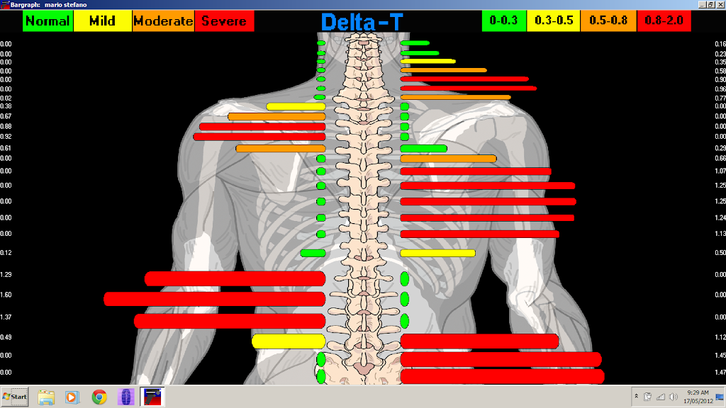 Vital Family Chiropractic | Suite 5/149 Brebner Dr, West Lakes SA 5021, Australia | Phone: (08) 8353 0599