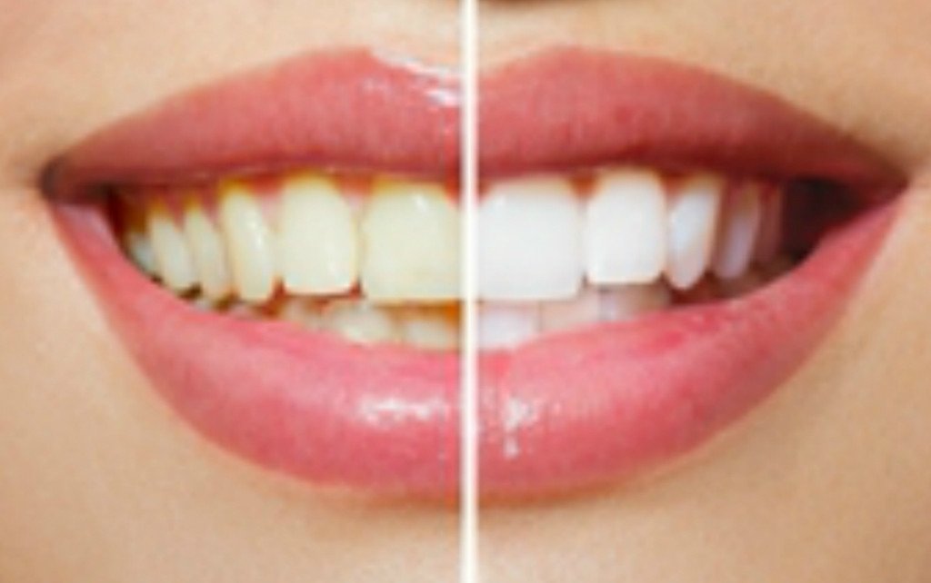 Smile ConfiDENTAL | dentist | 52 Redmyre Rd, Strathfield NSW 2135, Australia | 0280659996 OR +61 2 8065 9996
