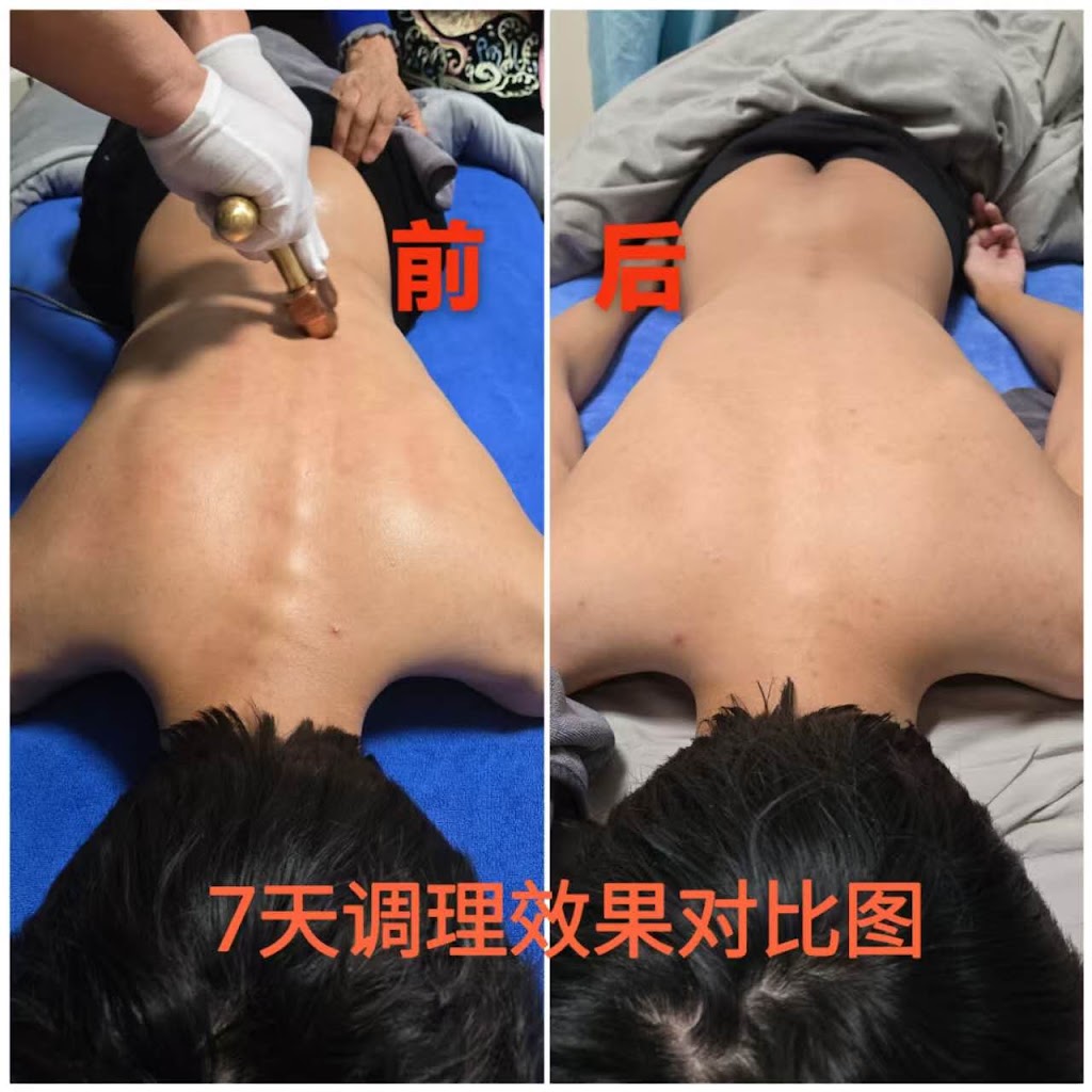 My Health Remedial Massage | inside My Health Medical Center, 4 Terry Rd, Box Hill NSW 2765, Australia | Phone: 0435 163 566