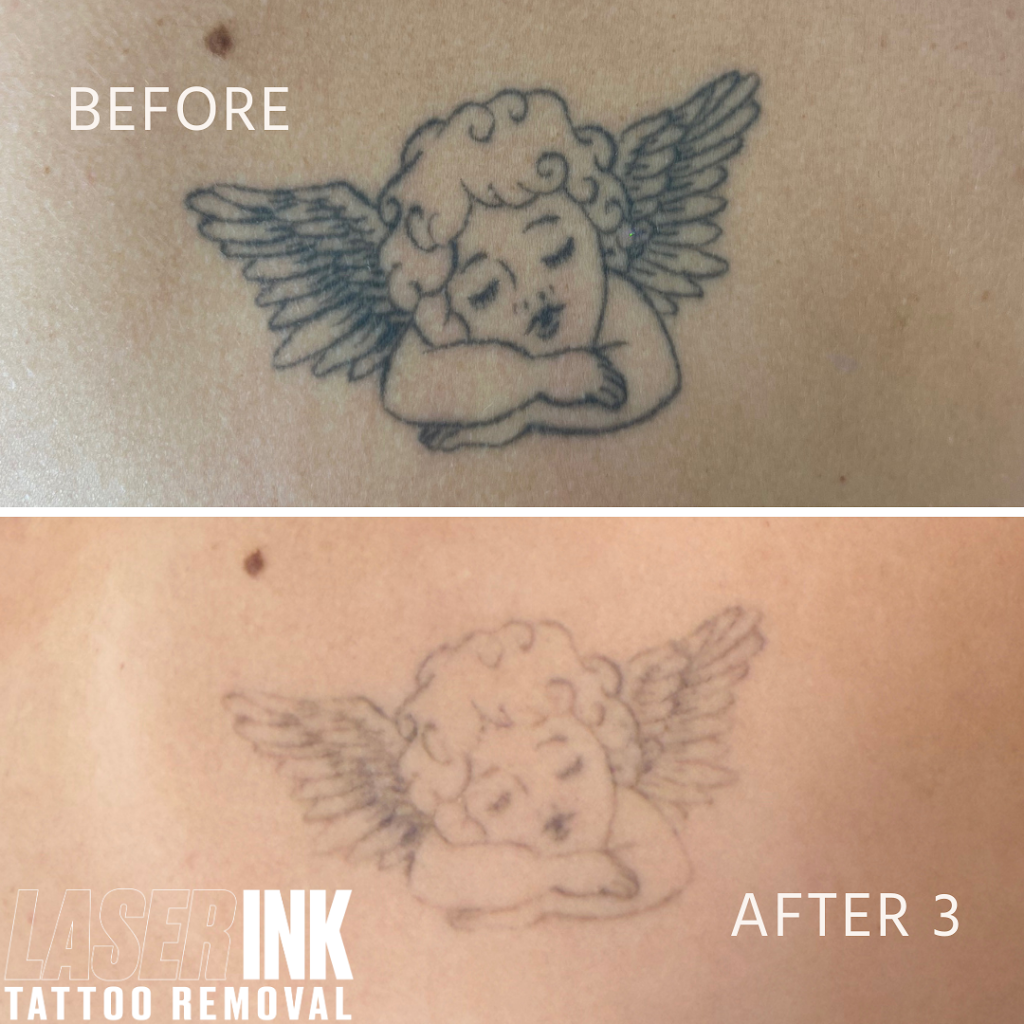 Laser Ink | 11/260 Captain Cook Dr, Kurnell NSW 2331, Australia | Phone: 0413 850 148