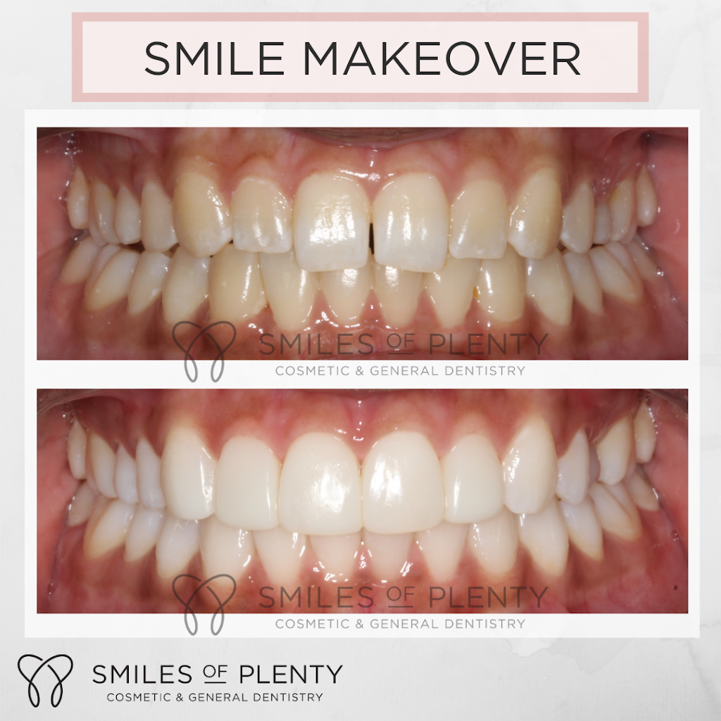 Smiles of Plenty | dentist | 28 Kurrak Rd, Yarrambat VIC 3091, Australia | 0394362949 OR +61 3 9436 2949