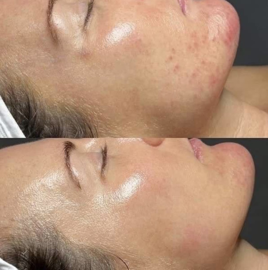 VALE SKIN AND BEAUTY | 38 Titmarsh Cct, Fernvale QLD 4306, Australia | Phone: 0422 921 911