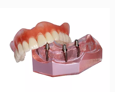 A B DENTURES | dentist | 122 derrimut rd opposite werribee pacific shopping centre, Hoppers Crossing VIC 3029, Australia | 0397486666 OR +61 3 9748 6666