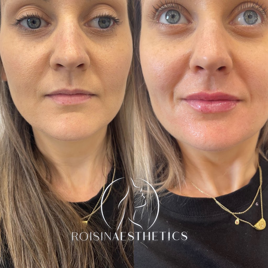 Roisin Aesthetics | health | 12 Vampire Ct, Hastings VIC 3915, Australia | 0423016973 OR +61 423 016 973