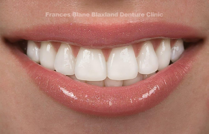Blaxland Cottage Denture Clinic | dentist | 172 Great Western Hwy, Blaxland NSW 2774, Australia | 0247390885 OR +61 2 4739 0885