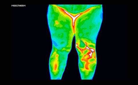 Thermo-Med Australia - Medical Thermography | health | 50 Blytheswood Ave, Warrawee NSW 2074, Australia | 0419144837 OR +61 419 144 837