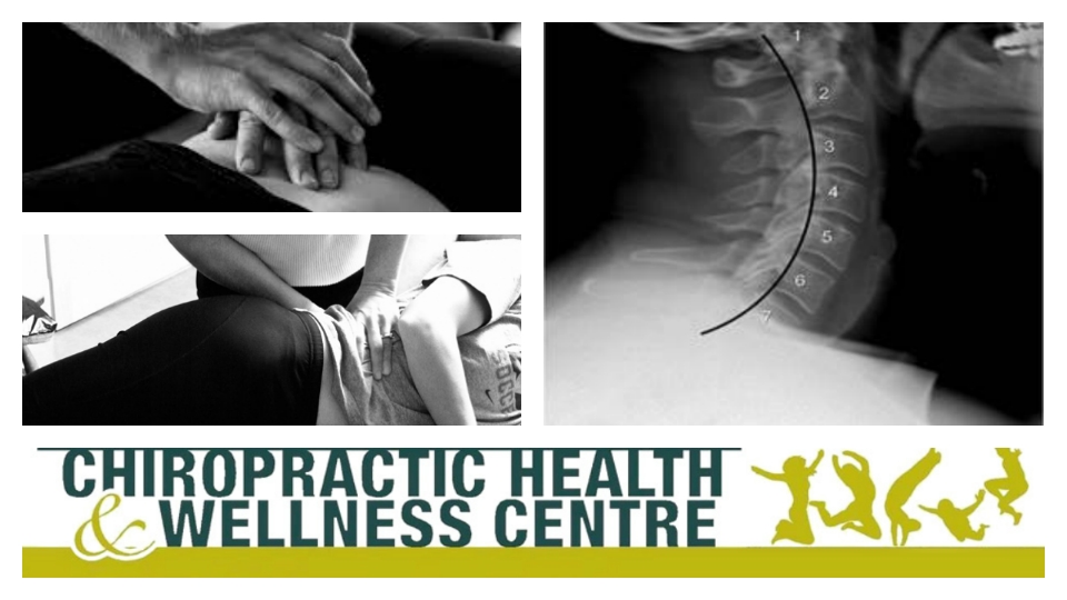 Orange Chiropractic Health and Wellness Centre | health | Level 2/1521 Forest Rd, Orange NSW 2800, Australia