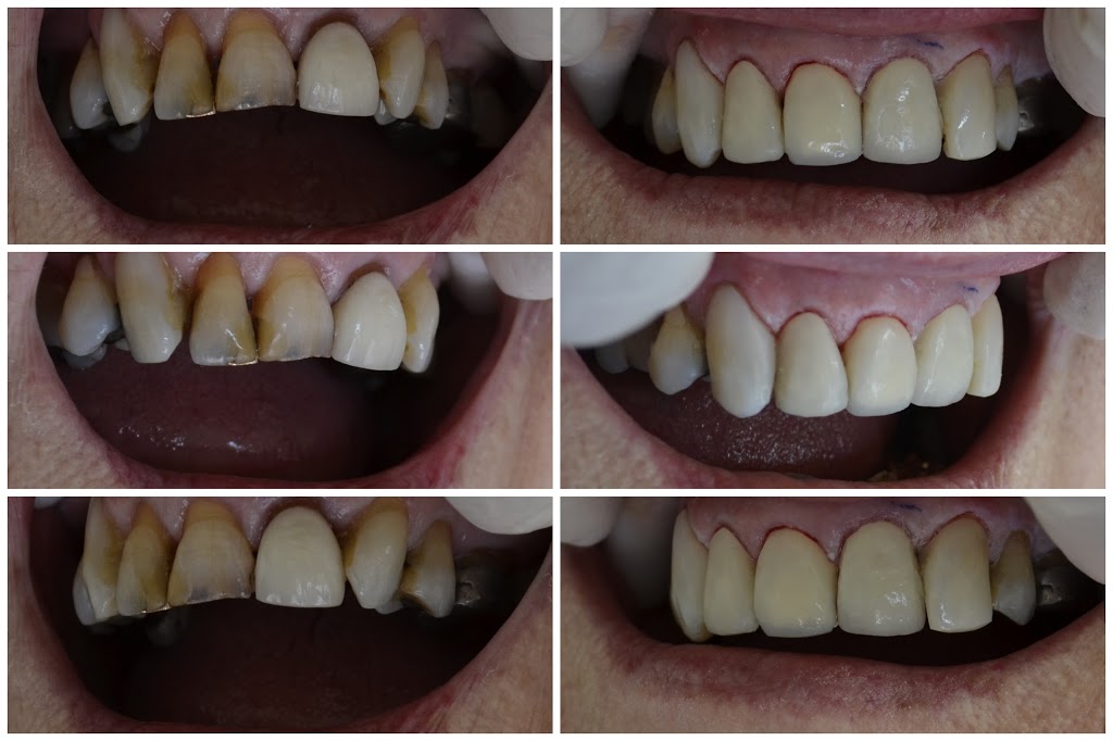 MP Dental Corowa | dentist | 8 River St, Corowa NSW 2646, Australia | 0260331213 OR +61 2 6033 1213