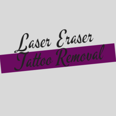 Laser Eraser Tattoo Removal & Beauty | 91 Cobbora Rd, Dubbo NSW 2830, Australia | Phone: 0490 085 468