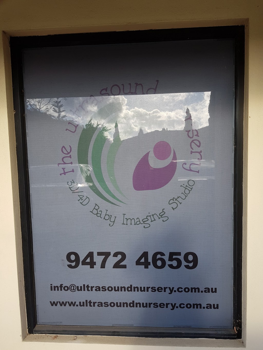 The Ultrasound Nursery 3D/4D Baby Imaging Studio | 5/107-109 Orrong Rd, Rivervale WA 6103, Australia | Phone: 0458 888 576