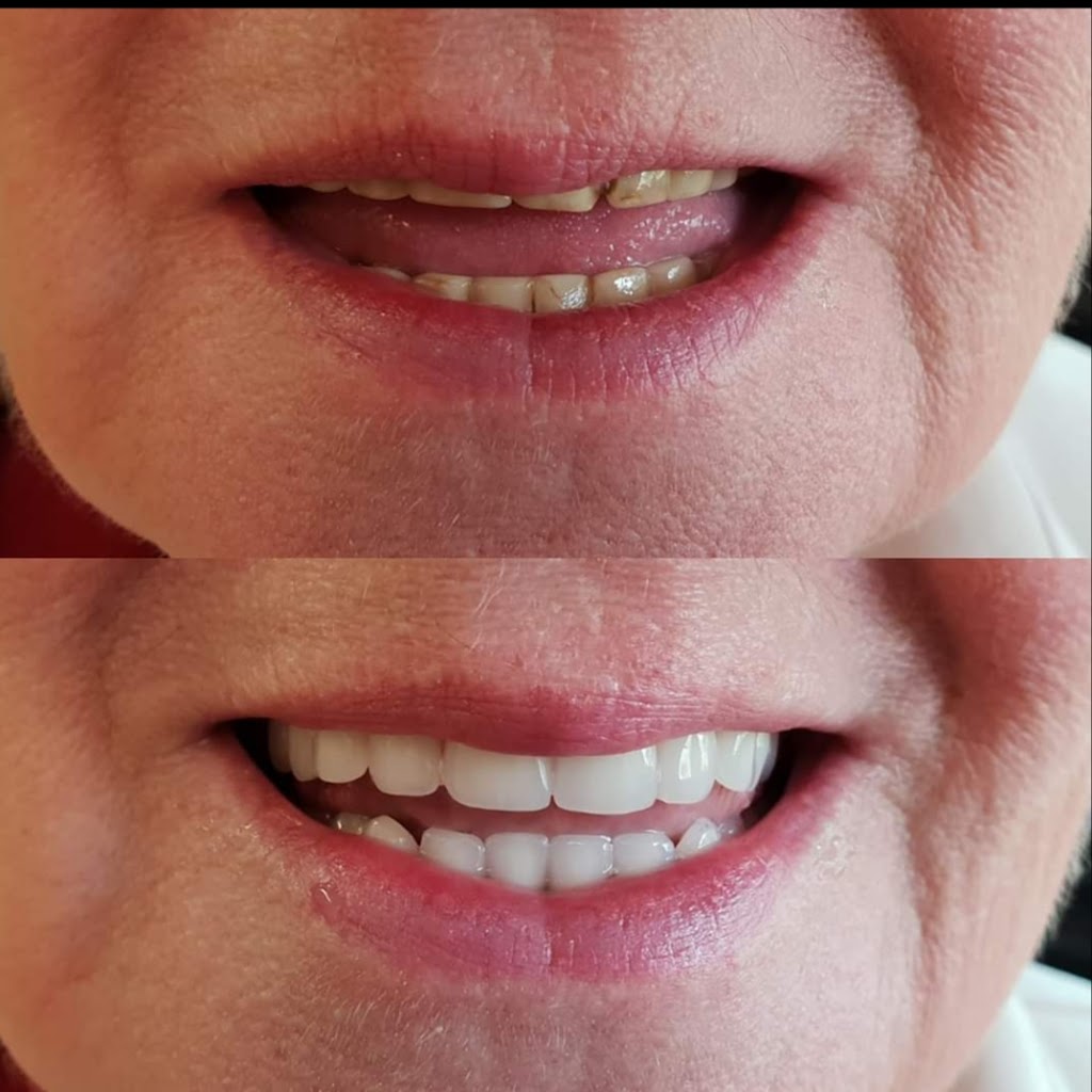 Purely Prosthetics Dental Laboratory | dentist | 9 Lister St, Swan View WA 6056, Australia | 0402486743 OR +61 402 486 743