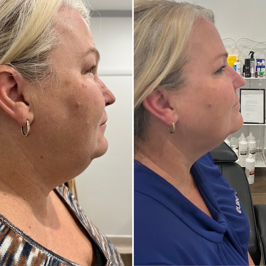 Oh My Skin Maitland | 43 Louth Park Rd, South Maitland NSW 2320, Australia | Phone: 0485 997 894