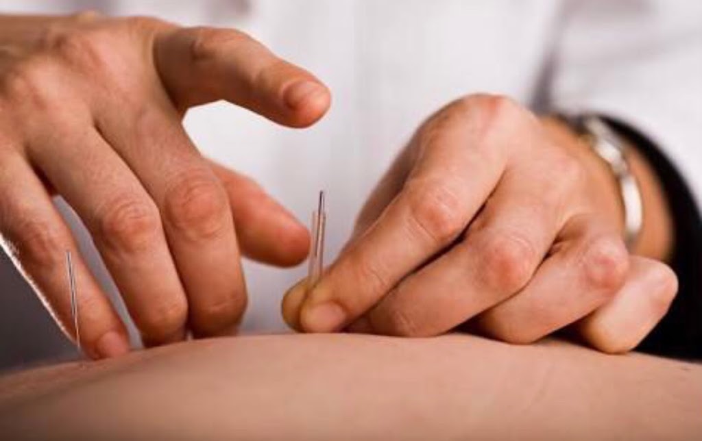 Acupuncture Clinic, Dr. Robin Tim So | health | 63 Warrener St, Nerang QLD 4211, Australia | 0755273001 OR +61 7 5527 3001