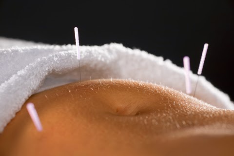 Melbourne Acupuncture | health | 206/122 Toorak Rd, South Yarra VIC 3141, Australia | 0398045775 OR +61 3 9804 5775